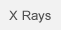 X-ray Systems